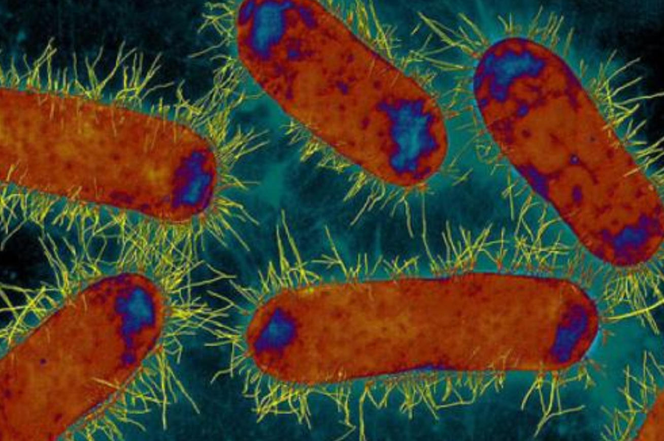 microscopic image of superbugs